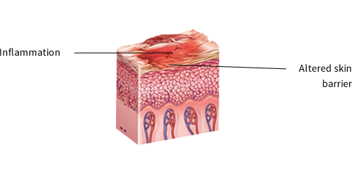 SECALIA